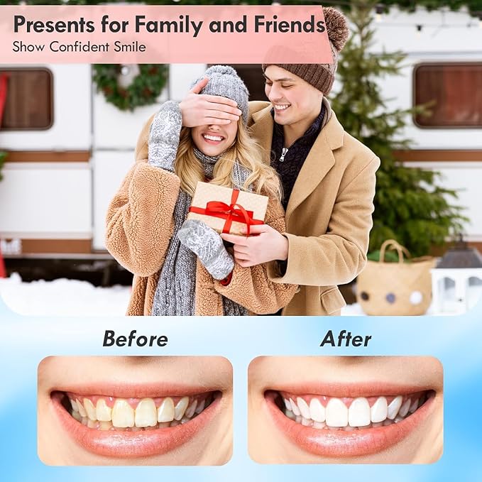 Spin Smile 360" Professional Grade Tooth Polisher