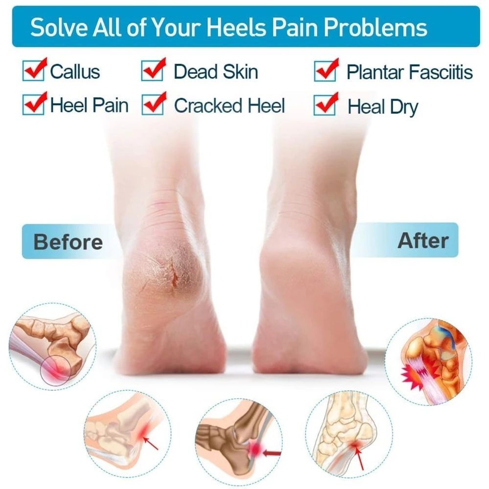 Silicone Gel Heel Pad Socks | Pain Relief & Anti‑Crack | 1 Pair Heel Guards & Protectors For Men & Women